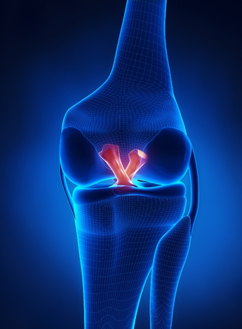 Graphic showing posterior and anterior cruciate ligaments